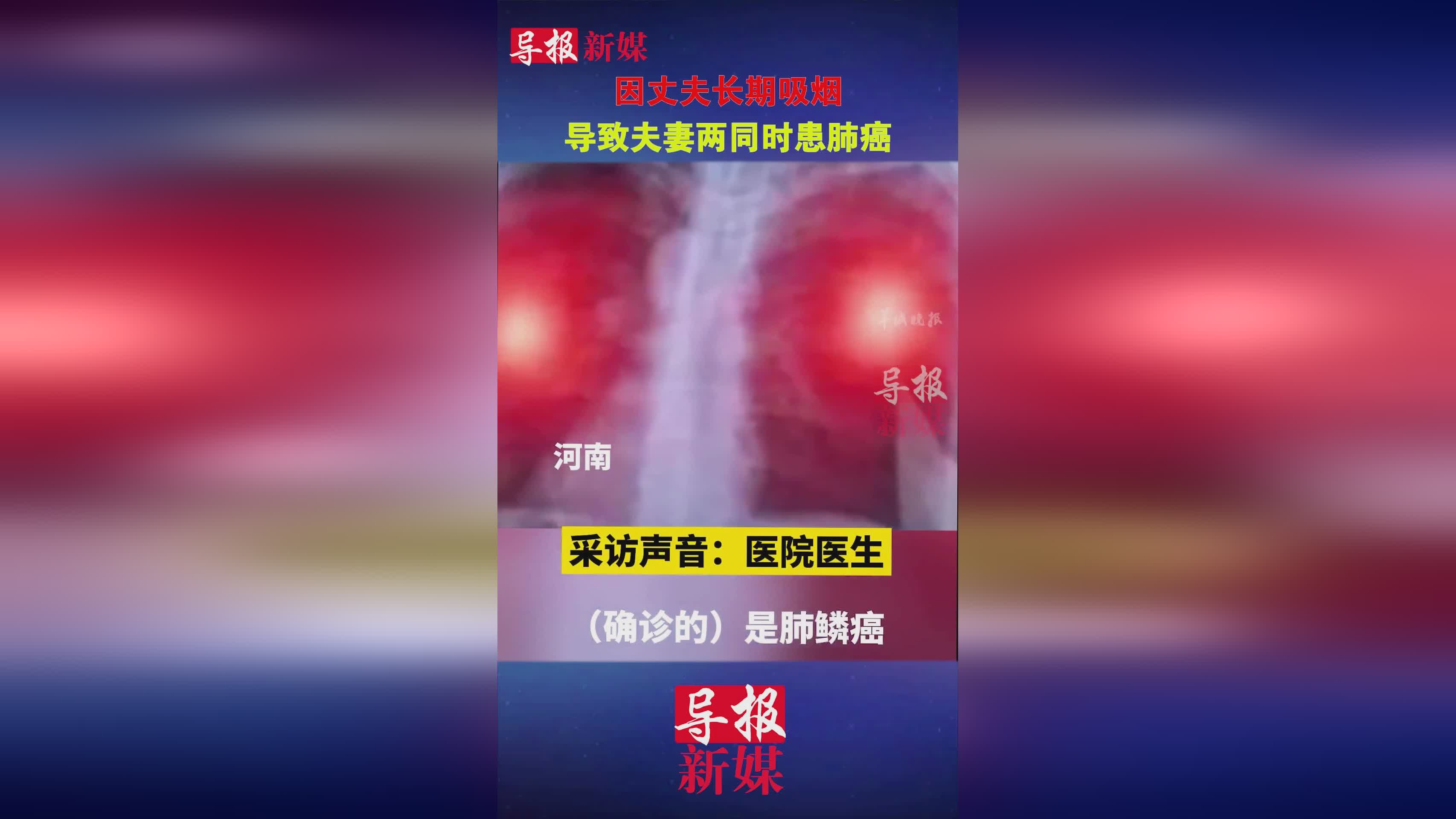 奇诚庸_能够让身体的肌肉恢复到原样，吸烟的老年人患肺癌的风险升高了5
