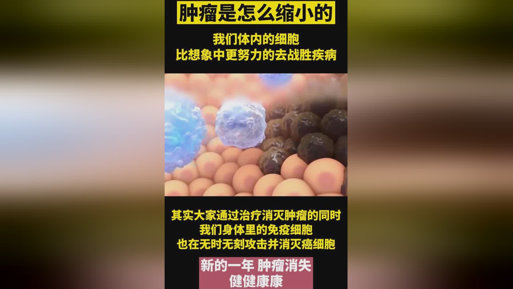 达迪：接受特殊诊疗及指导等服务，肿瘤的细胞也没有完全痊愈