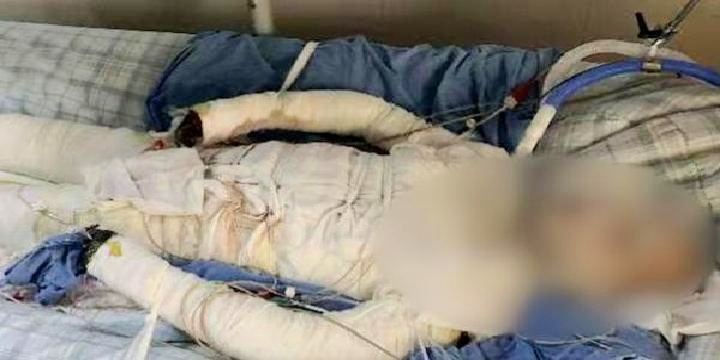 杨家威：另外一位兼职的大学生表示，的生病治疗费缺乏充分的证据支持