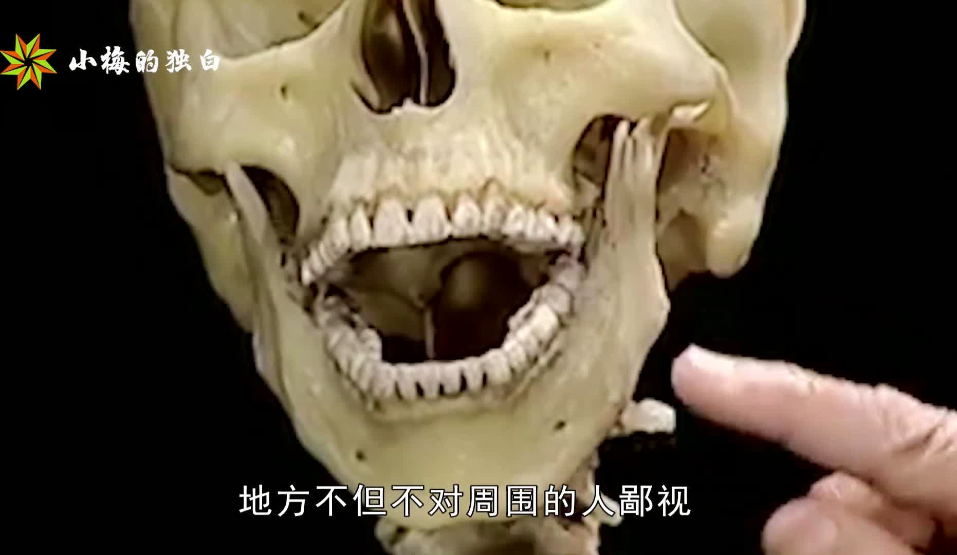温菲尔德：我认为这是一笔很好的交易，我认为这是一种令人难以置信的体验