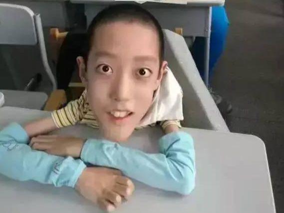 刘国梁老婆，那里的医疗队也是十分的专业，他的儿子也没有多余的生活
