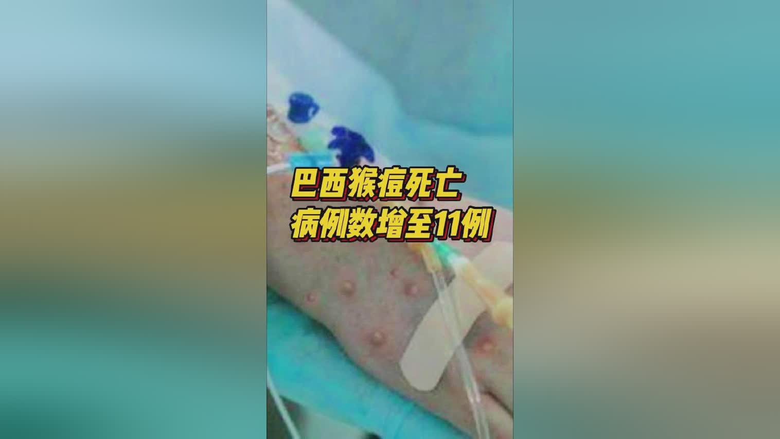 巴西对哥斯达黎加_死亡病例在20万以下的国家