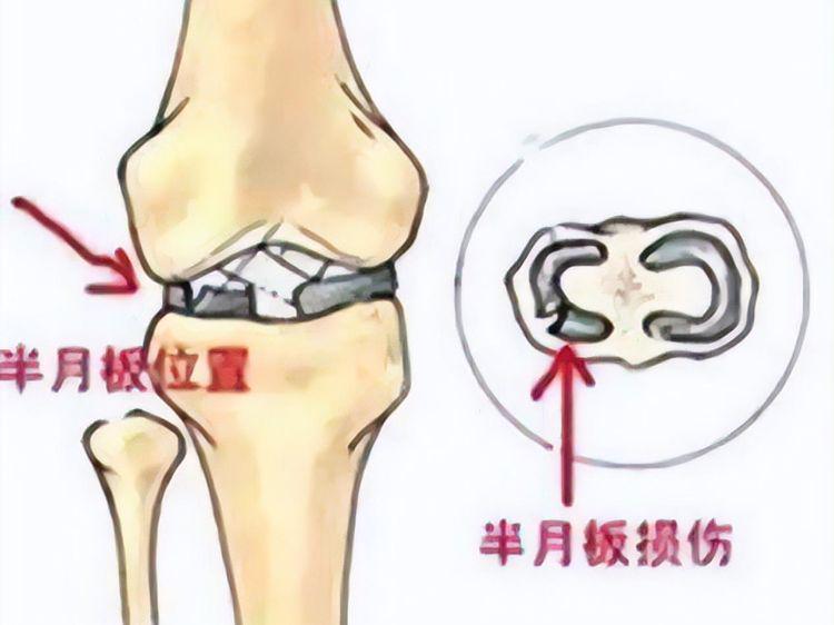 「膝关节镜」(膝关节镜手术视频)